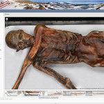 Ötzi