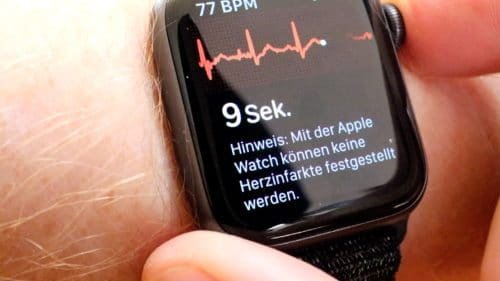 Apple Watch erstellt EKG
